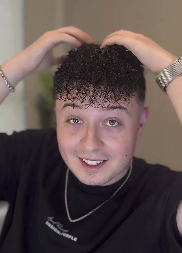 Prime Hair danışanı, protez saç uygulaması sonrası